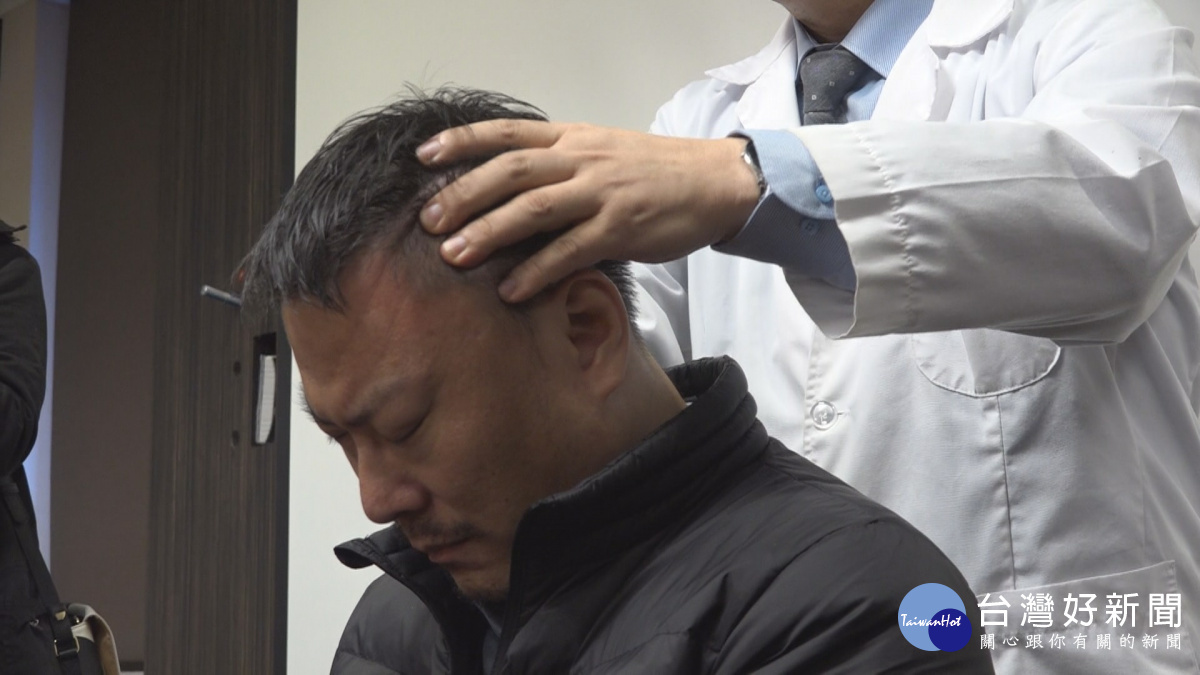 掉髮年輕化　按摩頭頂「黃金三點」防落髮