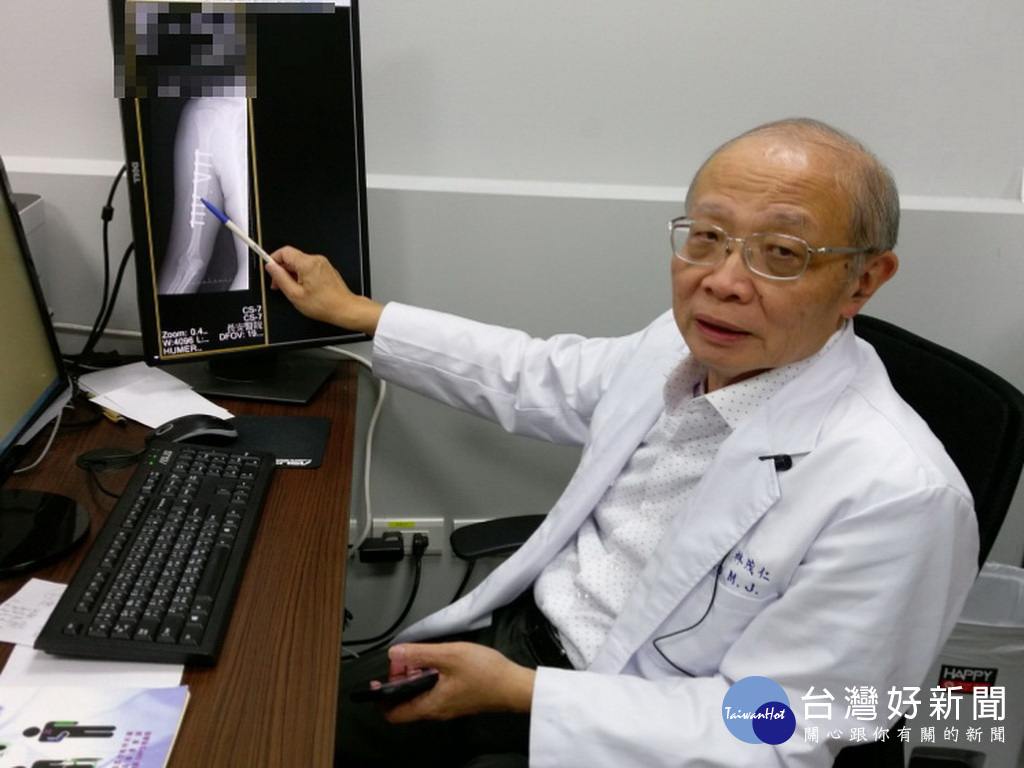 軌道門夾手骨折傷神經　印尼外傭險手癱被遣返