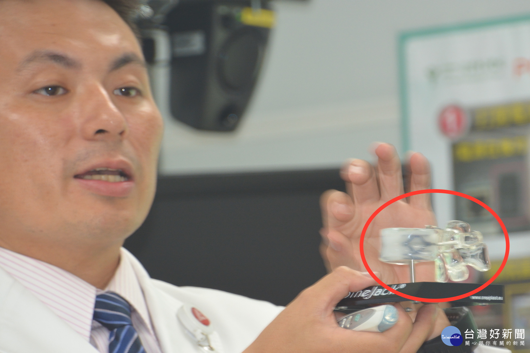 脊椎「千斤頂」支架極顯微手術　讓瀕癱瘓前蛙人免終身躺病床