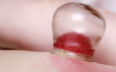 拔罐后能不能吹空調 拔罐后不宜做7件事