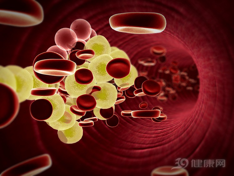 水是最好的“抗血栓葯”！遠離血栓，多喝一種“水”