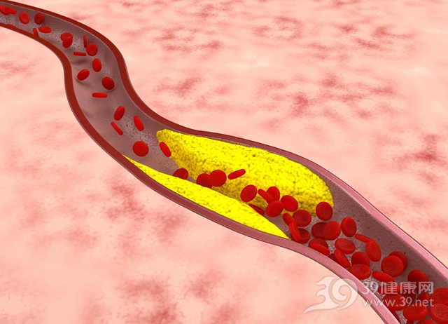 怕膽固醇高不吃肉？其實這些才是你該防的！
