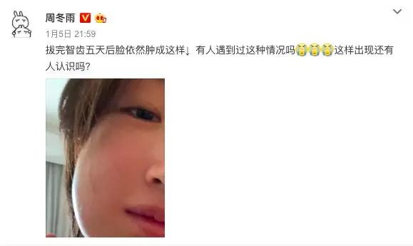 智齒不拔行不行？這可能不是你說了算