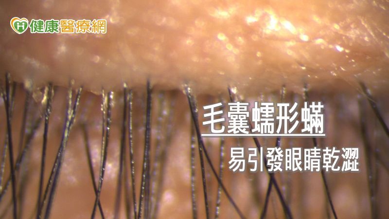 在家防疫兼追劇　小心乾眼找上你！