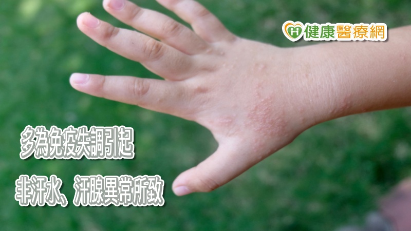 汗皰疹為什麼這麼癢？　夏日調理減少發作頻率_菜花