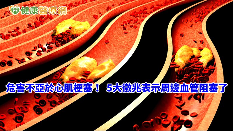 傷口難癒、手腳冰冷…　這5徵兆危害不亞於心肌梗塞_菜花