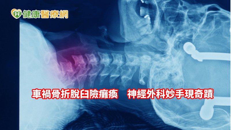 被車撞險斷頸　神經外科妙手拯救免癱瘓_減肥天龍國
