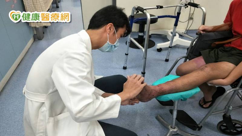 男子遇車禍險截肢　顯微血管皮瓣救回他的腳　_兒童牙齒矯正
