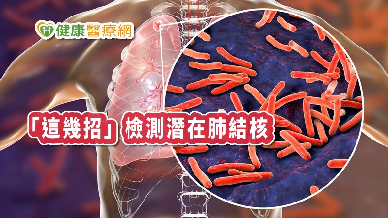 咳嗽帶痰、胸痛？　七分篩檢法揪出「肺結核」_減重天母